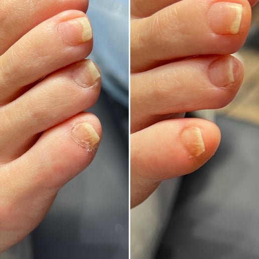 フットケア〜ベーシック〜