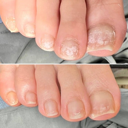 フットケア〜スペシャル〜