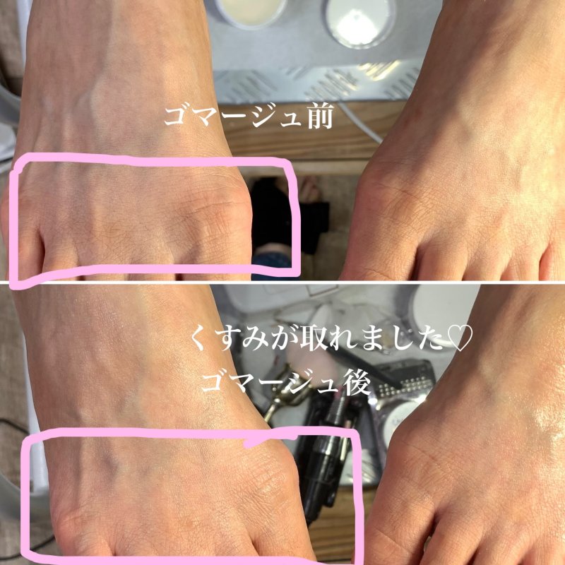 角質ケア〜プレミアム〜