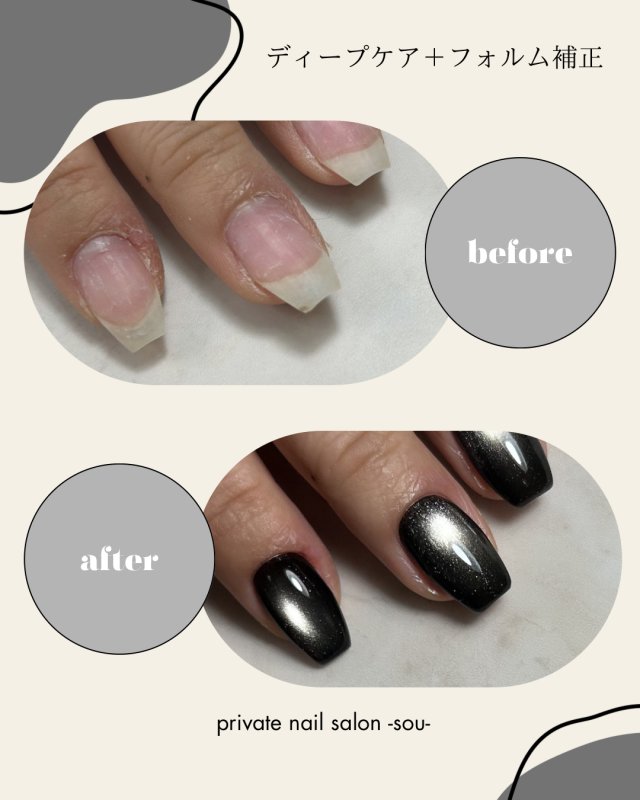 ディープケア＋フォルム補正