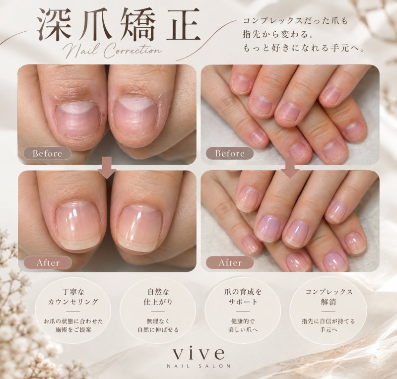 深爪コンプレックス解消
