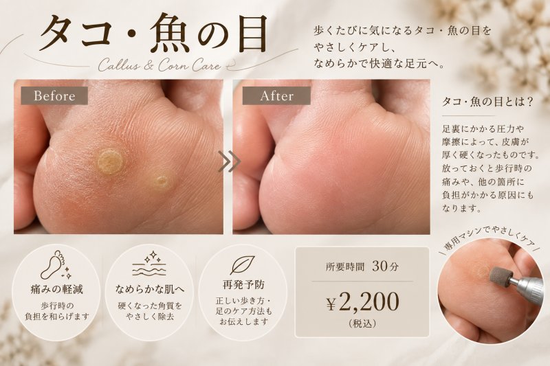タコ・魚の目ケア